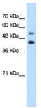 GTP Binding Protein 2 antibody, TA344163, Origene, Western Blot image 