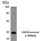 Indian Hedgehog Signaling Molecule antibody, GTX53061, GeneTex, Western Blot image 