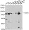 Transforming Growth Factor Beta Receptor 2 antibody, A1415, ABclonal Technology, Western Blot image 