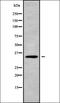 Troponin T1, Slow Skeletal Type antibody, orb338772, Biorbyt, Western Blot image 