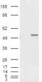 Aldehyde Dehydrogenase 1 Family Member A1 antibody, EB07138, Everest Biotech, Western Blot image 