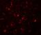 Small G Protein Signaling Modulator 1 antibody, A12048, Boster Biological Technology, Immunofluorescence image 