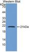 Cyclase Associated Actin Cytoskeleton Regulatory Protein 2 antibody, LS-C299280, Lifespan Biosciences, Western Blot image 