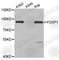 Forkhead Box P1 antibody, A5272, ABclonal Technology, Western Blot image 