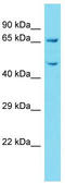 Kelch Repeat And BTB Domain Containing 12 antibody, TA337371, Origene, Western Blot image 