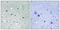 Large Tumor Suppressor Kinase 1 antibody, LS-C199191, Lifespan Biosciences, Immunohistochemistry paraffin image 