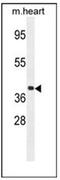 G Protein Subunit Alpha 15 antibody, AP51872PU-N, Origene, Western Blot image 