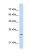 Myeloid Leukemia Factor 2 antibody, orb325282, Biorbyt, Western Blot image 