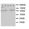 Glutathione S-Transferase Pi 1 antibody, orb76104, Biorbyt, Western Blot image 