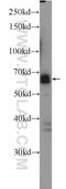 SPT7 Like, STAGA Complex Gamma Subunit antibody, 25606-1-AP, Proteintech Group, Western Blot image 