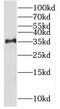 Rhomboid Domain Containing 1 antibody, FNab07277, FineTest, Western Blot image 