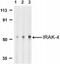 Interleukin 1 Receptor Associated Kinase 4 antibody, NBP1-77231, Novus Biologicals, Western Blot image 