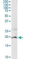 Cytochrome B5 Type A antibody, H00001528-M05, Novus Biologicals, Western Blot image 