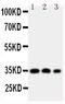 Homeobox A4 antibody, PA5-79389, Invitrogen Antibodies, Western Blot image 