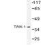 Potassium Two Pore Domain Channel Subfamily K Member 1 antibody, LS-C177486, Lifespan Biosciences, Western Blot image 