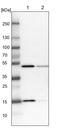 RNA Polymerase II Subunit H antibody, PA5-58085, Invitrogen Antibodies, Western Blot image 