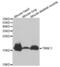 Troponin C1, Slow Skeletal And Cardiac Type antibody, abx001574, Abbexa, Western Blot image 