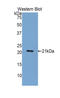 Alpha-1-acid glycoprotein antibody, LS-C292721, Lifespan Biosciences, Western Blot image 