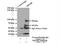 Transient Receptor Potential Cation Channel Subfamily M Member 5 antibody, 18027-1-AP, Proteintech Group, Immunoprecipitation image 