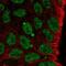 Krueppel-like factor 8 antibody, NBP2-57740, Novus Biologicals, Immunofluorescence image 