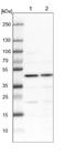 Nucleoporin 58 antibody, NBP2-13684, Novus Biologicals, Western Blot image 