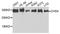 Chromodomain Helicase DNA Binding Protein 4 antibody, STJ111945, St John