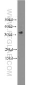Toll Like Receptor Adaptor Molecule 2 antibody, 19524-1-AP, Proteintech Group, Western Blot image 