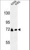 Glutamine-Fructose-6-Phosphate Transaminase 2 antibody, LS-C166448, Lifespan Biosciences, Western Blot image 