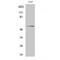 Akt antibody, LS-C381976, Lifespan Biosciences, Western Blot image 