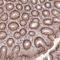 Zinc Finger BED-Type Containing 5 antibody, NBP2-13533, Novus Biologicals, Immunohistochemistry frozen image 