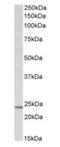 TIMP Metallopeptidase Inhibitor 1 antibody, orb125241, Biorbyt, Western Blot image 