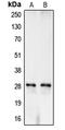 Carbonic Anhydrase 1 antibody, LS-C351898, Lifespan Biosciences, Western Blot image 