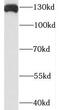 Pleckstrin Homology Domain Containing A5 antibody, FNab06536, FineTest, Western Blot image 