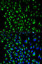 Lymphocyte Cytosolic Protein 2 antibody, STJ24385, St John