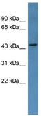 MAGE Family Member A11 antibody, TA342766, Origene, Western Blot image 