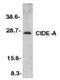 Cell Death Inducing DFFA Like Effector A antibody, NBP1-76950, Novus Biologicals, Western Blot image 