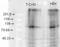 Potassium Voltage-Gated Channel Subfamily Q Member 2 antibody, LS-C230701, Lifespan Biosciences, Western Blot image 