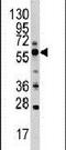 Golgi Associated PDZ And Coiled-Coil Motif Containing antibody, PA5-14114, Invitrogen Antibodies, Western Blot image 