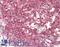Zinc Finger Protein 148 antibody, LS-B13524, Lifespan Biosciences, Immunohistochemistry paraffin image 