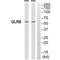 Glycine Receptor Beta antibody, A04017, Boster Biological Technology, Western Blot image 