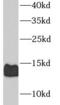 Calcitonin Related Polypeptide Beta antibody, FNab09768, FineTest, Western Blot image 