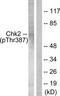 Serine/threonine-protein kinase Chk2 antibody, TA312767, Origene, Western Blot image 