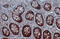 Galectin 3 antibody, GTX635151, GeneTex, Immunohistochemistry paraffin image 