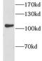 G Protein Regulated Inducer Of Neurite Outgrowth 1 antibody, FNab03615, FineTest, Western Blot image 