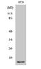 CRABP-II antibody, A03297-1, Boster Biological Technology, Western Blot image 