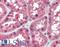 Isocitrate Dehydrogenase (NADP(+)) 1, Cytosolic antibody, LS-B3573, Lifespan Biosciences, Immunohistochemistry paraffin image 