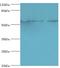 Protein Phosphatase 3 Catalytic Subunit Gamma antibody, MBS1497744, MyBioSource, Western Blot image 