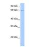 Chloride Voltage-Gated Channel Ka antibody, NBP1-80067, Novus Biologicals, Western Blot image 