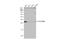 ADP/ATP translocase 3 antibody, NBP2-20393, Novus Biologicals, Western Blot image 