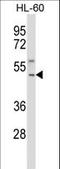 Tachykinin Receptor 1 antibody, LS-C161680, Lifespan Biosciences, Western Blot image 